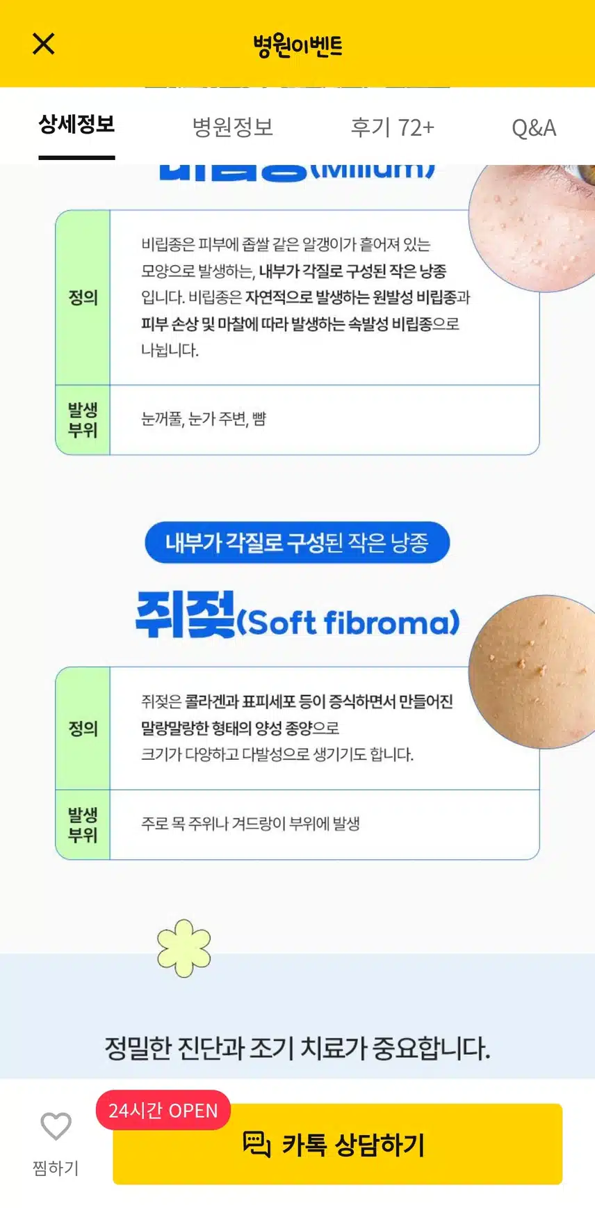 서울 서초구의 한관종 비립종 쥐젖제거 후기