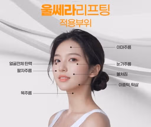 울쎄라 시술 받은 현실 리얼 후기 써봅니다 ㅎㅎ