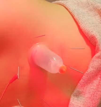 허리디스크로 인해 장기간 통원치료 받은 후기