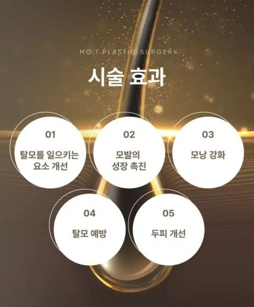 서울 강남 모원성형외과 두피정밀진단+두피LDM+모낭주사 후기 
