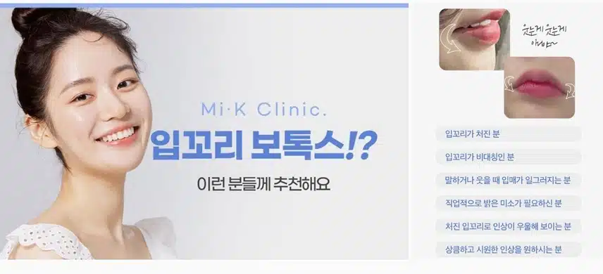서초구 미케이의원 입꼬리보톡스 4만9천원 후기 추천해요