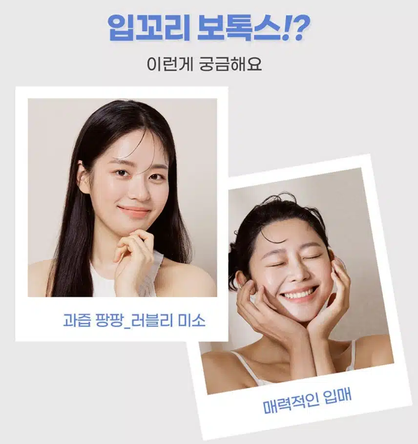 서초구 미케이의원 입꼬리보톡스 4만9천원 후기 추천해요