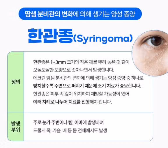 서울 서초구 플래너❤비립종,쥐젖 제거 후기 추천