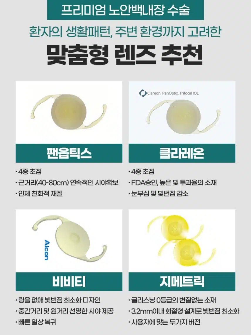  강남구 에스앤유안과의원 백내장수술 단안 25만원부터 후기!!