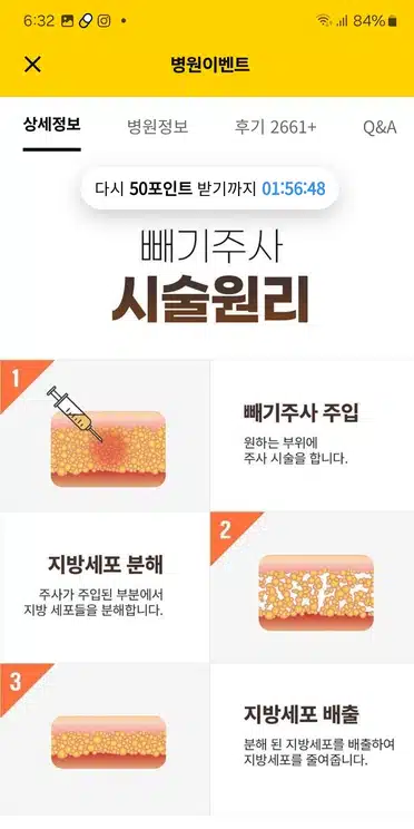 서초구 미케이 빼기주사 이벤트 후기좋네요