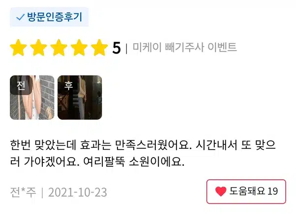 서초구 미케이 빼기주사 이벤트 후기좋네요