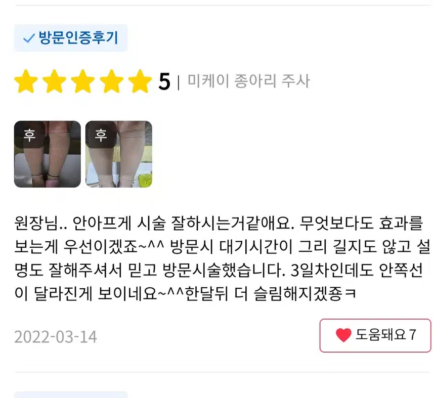 서초구 미케이의원 종아리 스키니 주사 9.9만원 후기 추천합니다