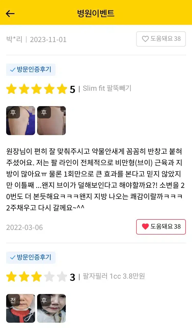 서초구 Slim fit 팔뚝빼기 후기 추천합니다