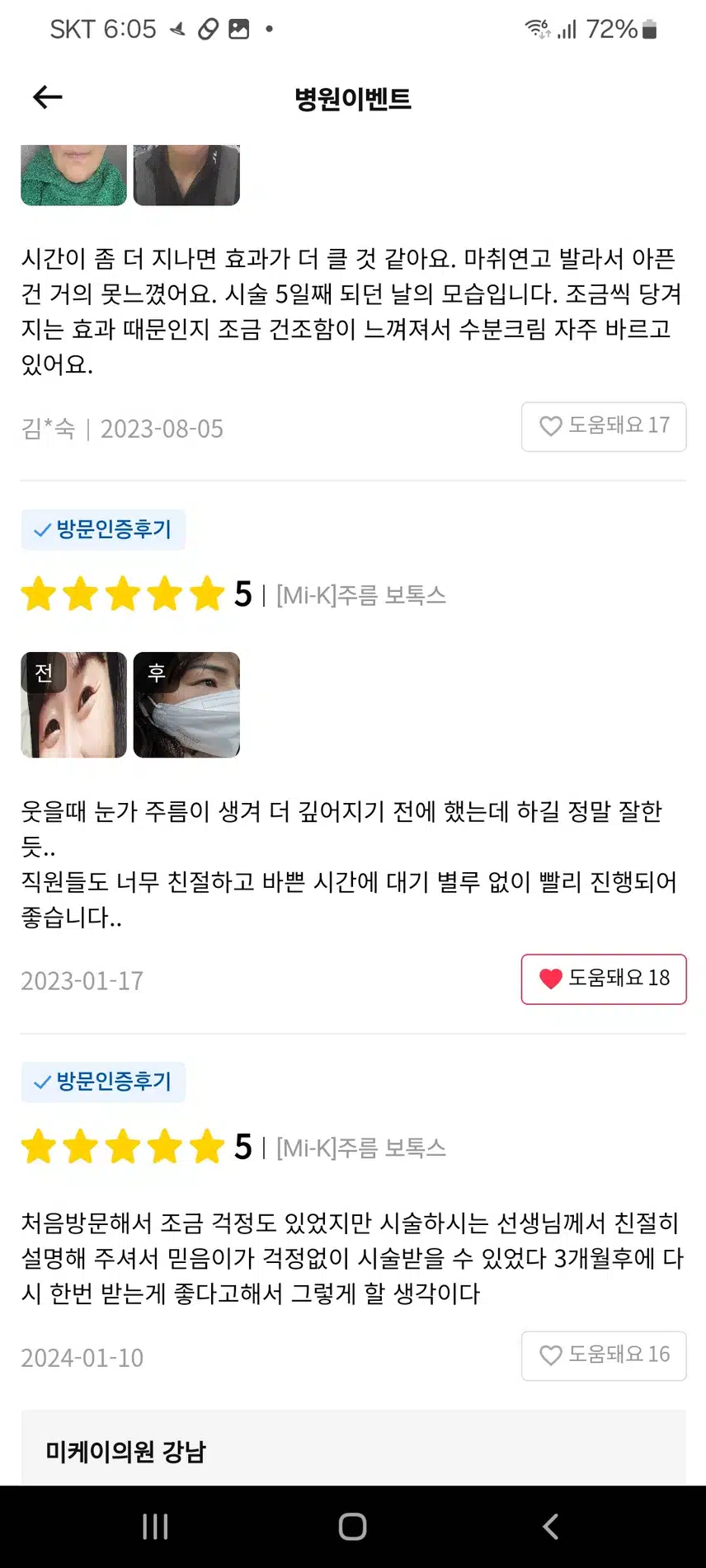 강남 서초구 미케이의원 주름보톡스 2.5만원 좋습니다