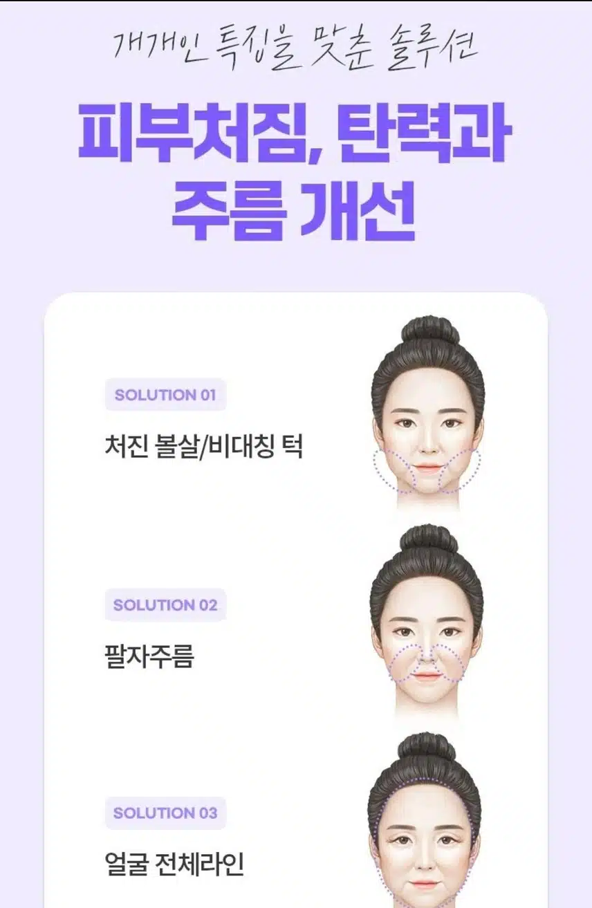 리팅성형외과 미니리프팅 후기 도움되요
