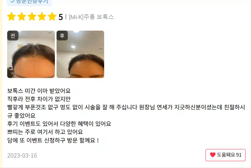 서초구 미케이의원 주름보톡스 후기