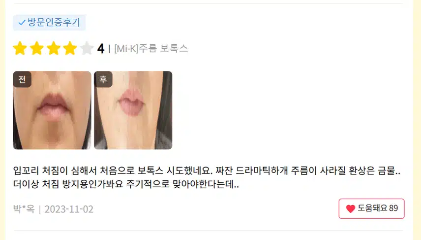 서초구 미케이의원 주름보톡스 후기