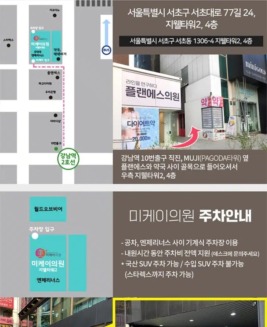 서초 미케이의원/ 주름 보톡스 2.5만원 /후기 추천합니다 