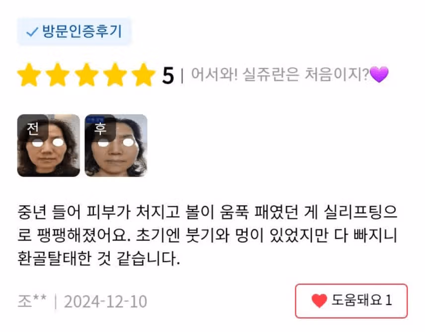 서울 강남구 어서와! 실쥬란은 처음이지?💜후기 추천
