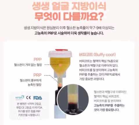 얼굴 지방이식 고민되어 상담받아봤어요