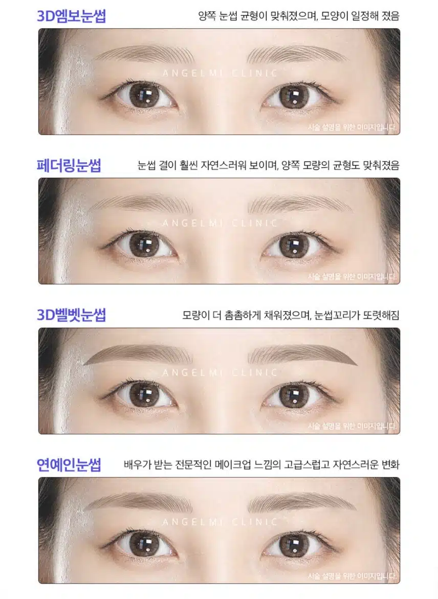 강남 엔젤미의원 눈썹반영구 7.9만원 후기 추천해요~