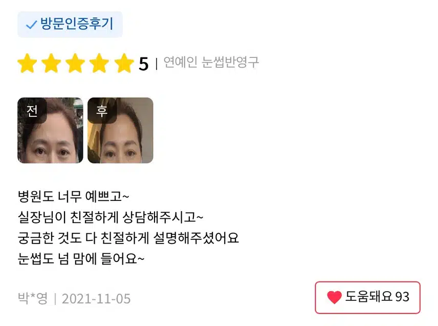 강남 엔젤미의원 눈썹반영구 7.9만원 후기 추천해요~