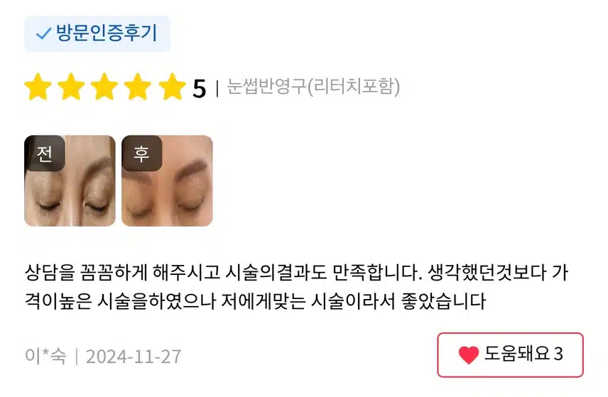 강남 엔젤미의원 눈썹반영구 7.9만원 후기 추천해요~