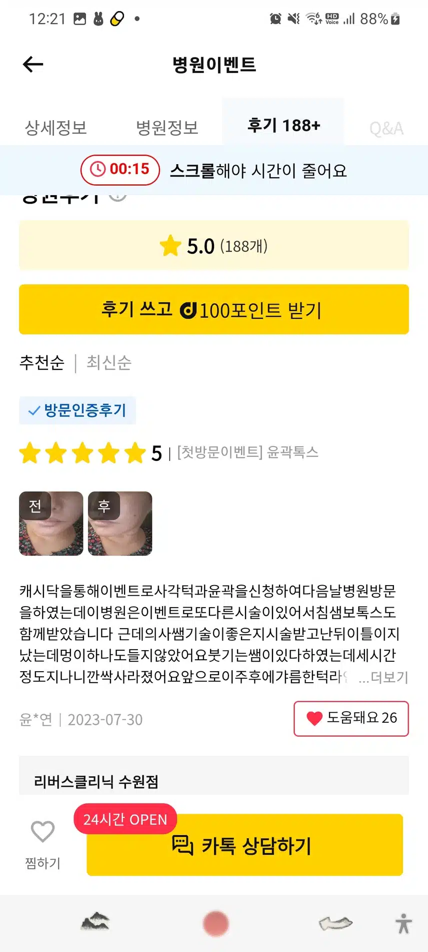 권선구 리버스클리닉수원점 무턱필러자갈턱9만원 후기 추천.