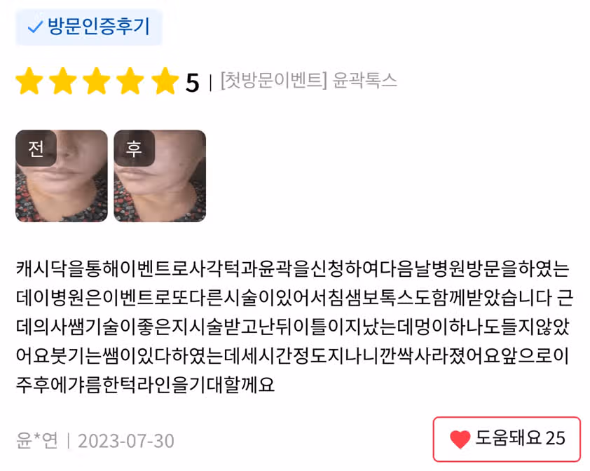 경기도 수원시 권선구 갸름한 V라인 윤곽톡스 후기