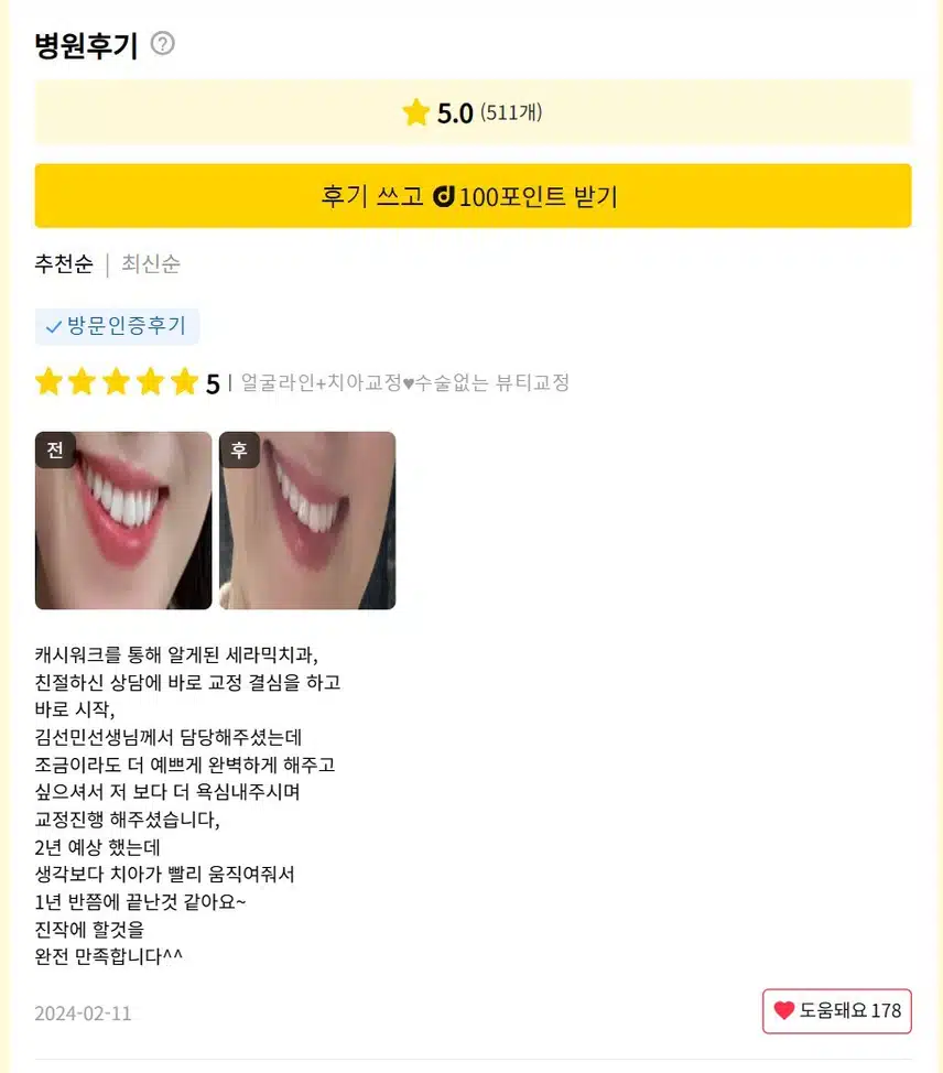 강남구 얼굴라인+치아교정♥수술없는 뷰티교정 후기 추천합니다.