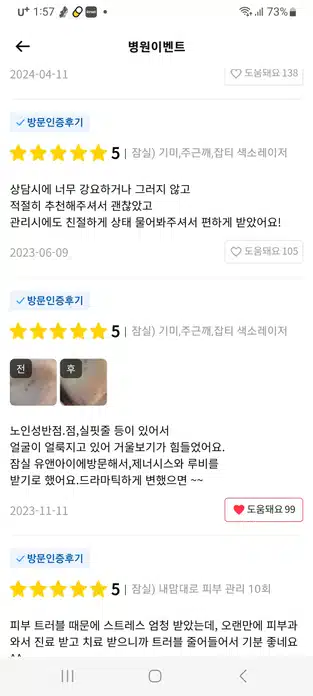 송파구 유앤아이의원 기미,주근깨,잡티 색소레이저 후기 궁금합니다