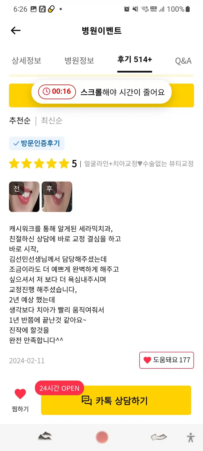 강남구세라믹치과 얼굴라인 치아교정15만원 후기추천.