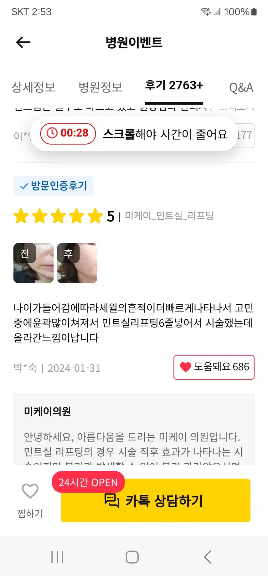강남 서초 팔자필러 1cc3.8만 후기