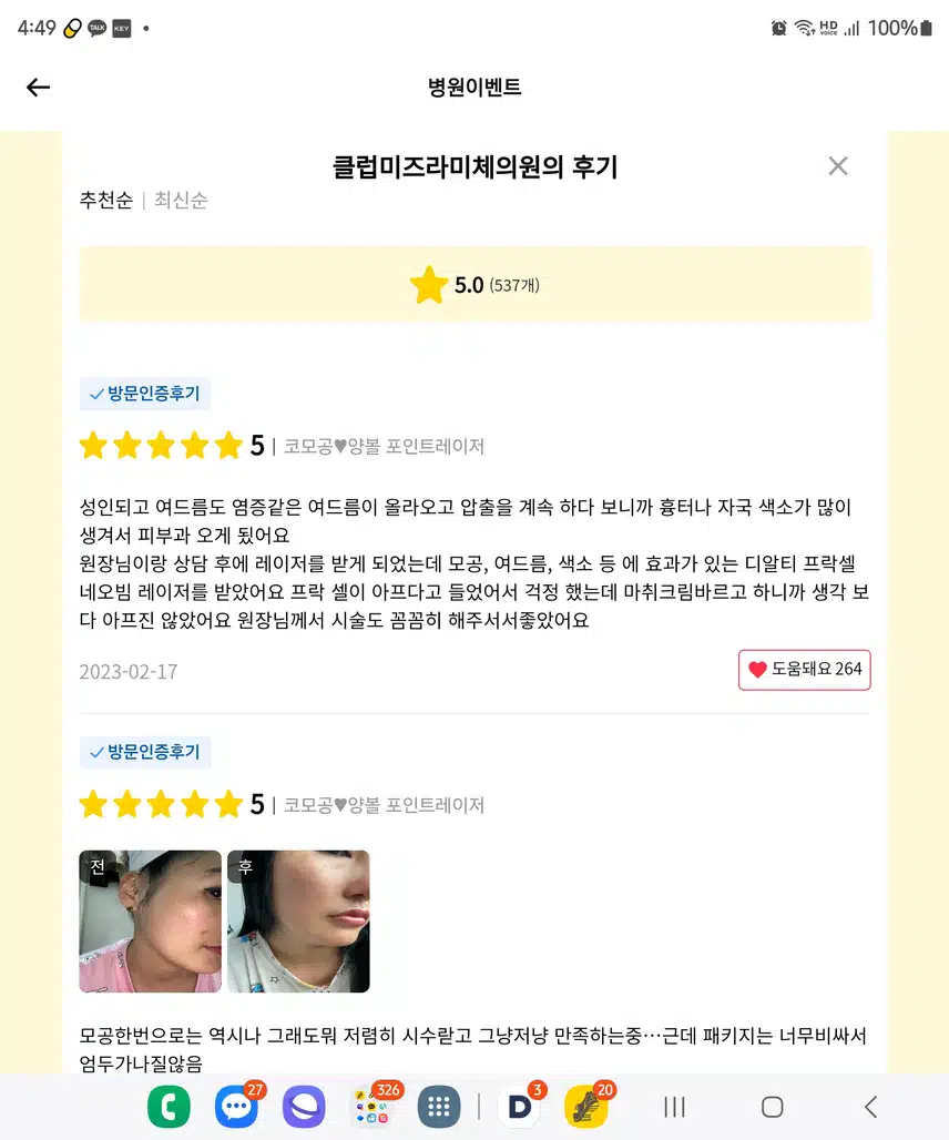 송파구 클럽미즈라미체의원(4차원피부측정, 피부레이저, 부분 집중레이저 27만원)후기 후기 추천