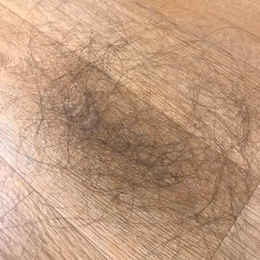 (질문) 머리 자주 감으면 탈모진행 속도도 빨라질까요??