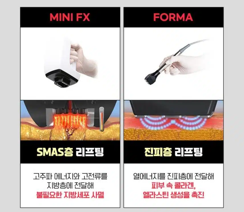 서초구 플래너성형외과의원 V라인 인모드 4만원 후기 추천