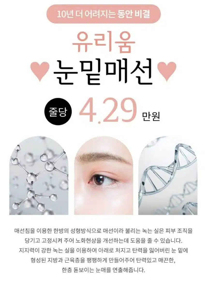 송파구 유리움 한의원 눈밑 매선 추천후기