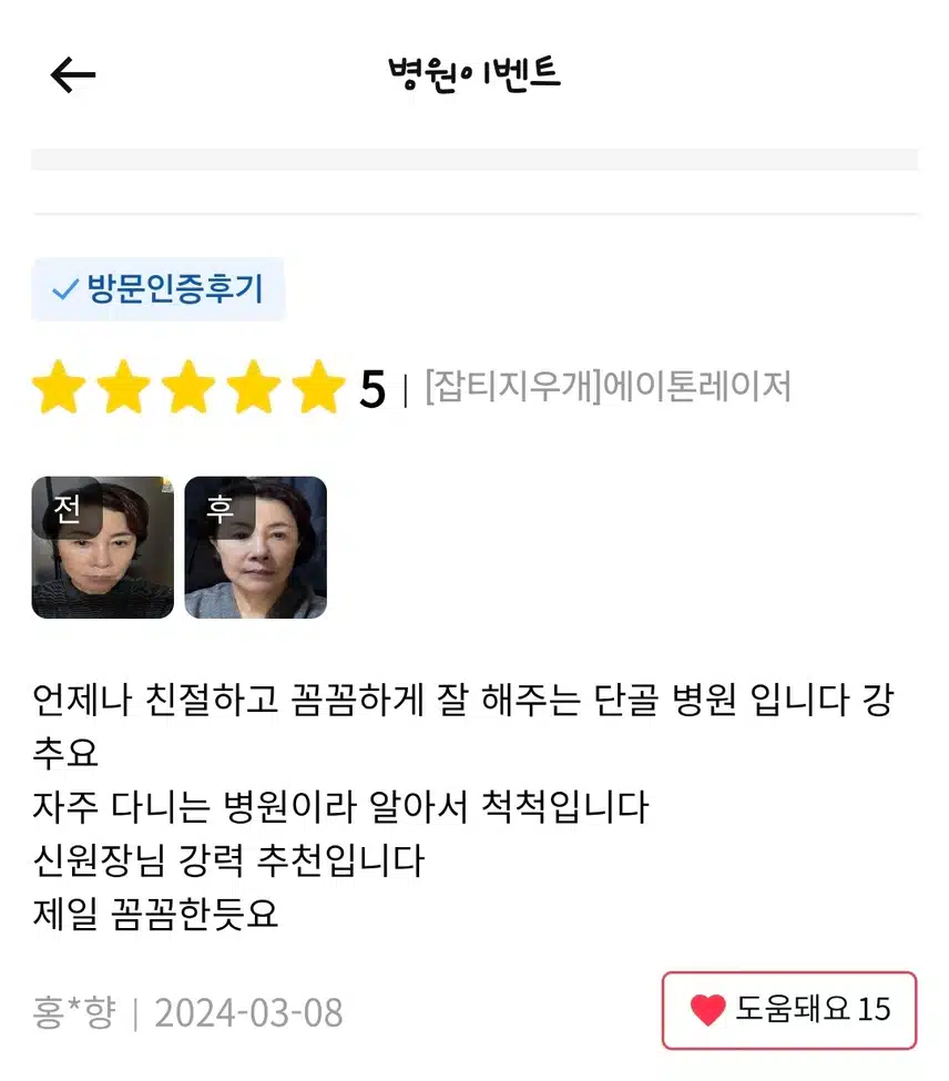 서초 미케이의원 잡티지우개 에이톤레이저 9.9만 후기 추천해요