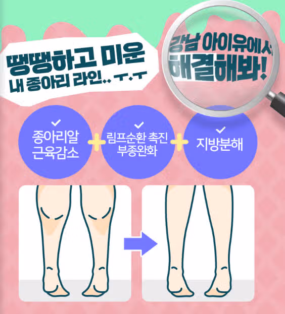 서울시 강남구 아이유 종아리 컷백주사 후기 추천