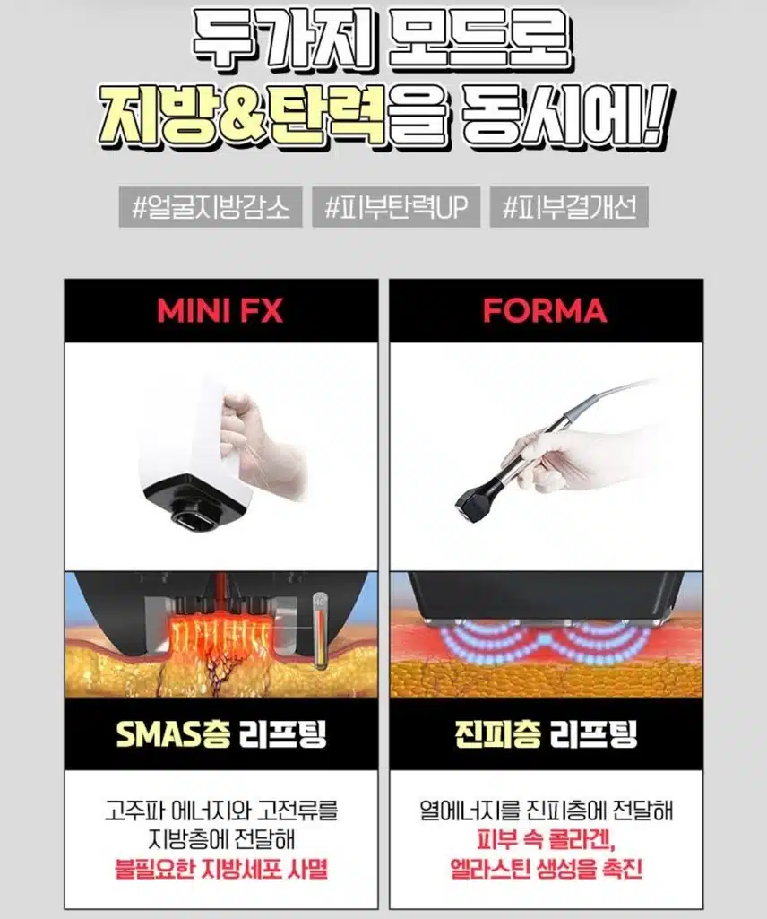 강남 서초구 플래너 V라인 인모드 4만원 후기!!