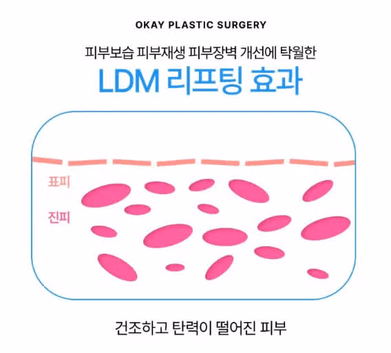 서울시 강남구 오케이 물광 LDM 후기 추천