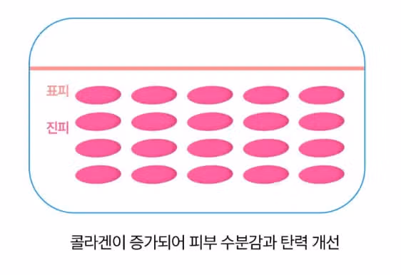 서울시 강남구 오케이 물광 LDM 후기 추천