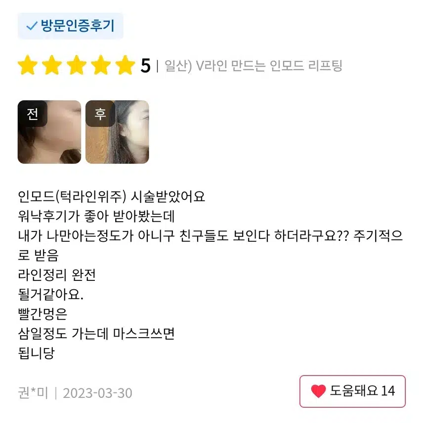 일산 V라인 만드는 인모드 리프팅 6.5만원 후기
