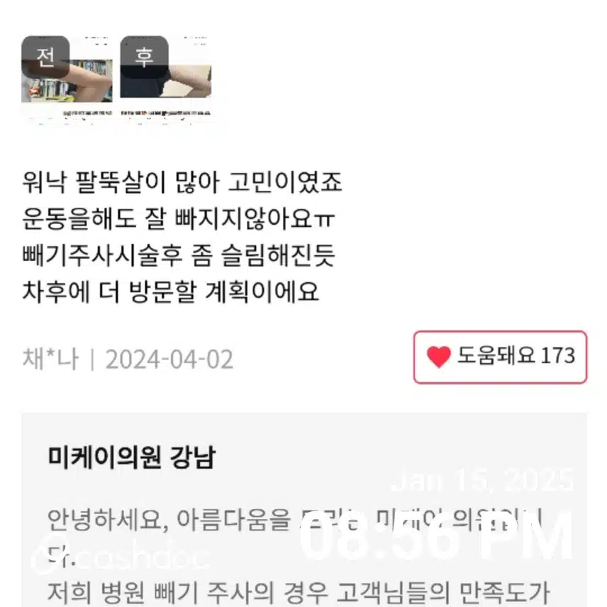 서초구 slim fit 팔뚝빼기 9.5만원 후기