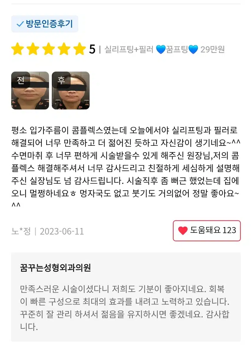 강남 실리프팅+필러 꿈프팅 29만원 후기좋네요 