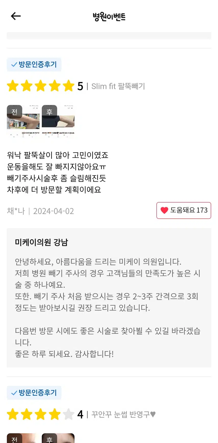 강남서초 미케이의원의 slimfit 팔뚝빼기 주사 후기를 추천합니다