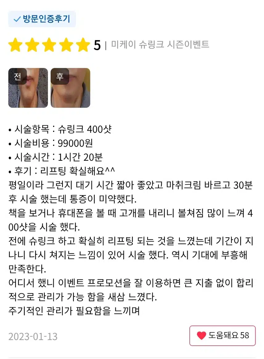 서초구 미케이의원 슈링크 시즌 이벤트 300샷 6.8만원 후기 추천합니다 