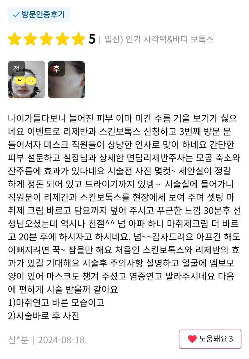 일산 인기 사각턱 & 바디 보톡스 7천원 후기