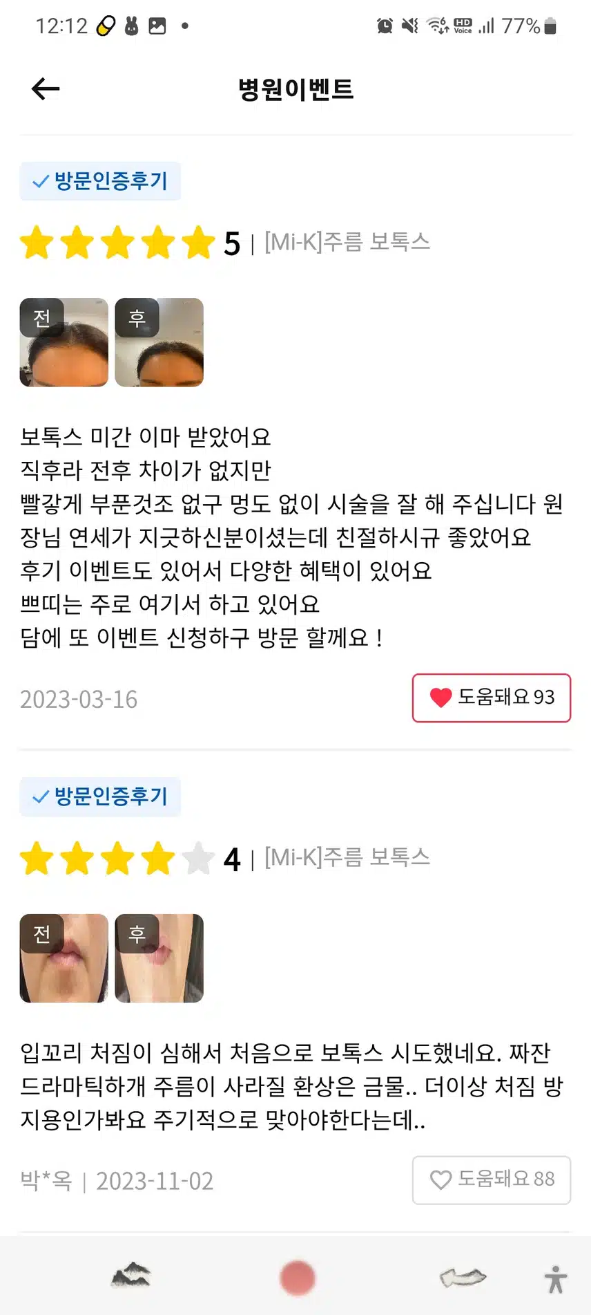 서초구 미케이의원 주름 보톡스 2.5만원 후기 추천.