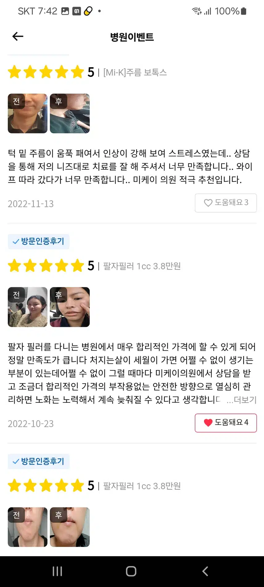 서초구 미케이의원 팔자필러 3.8만원 좋아요