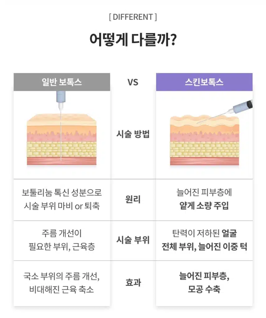 김포 쫀쫀 피부 스킨보톡스 7만8천 후기