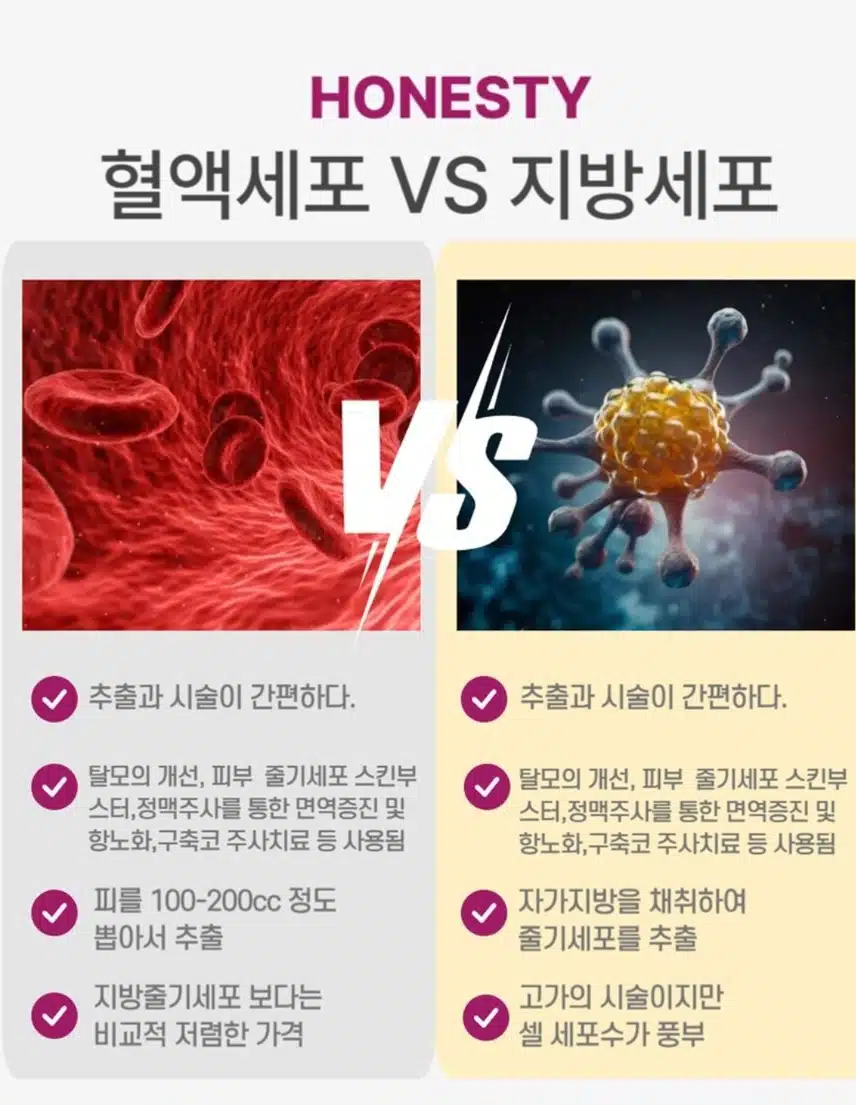 서초구 아너스티성형외과 노화,면역력강화 줄기세포 정맥주사 후기