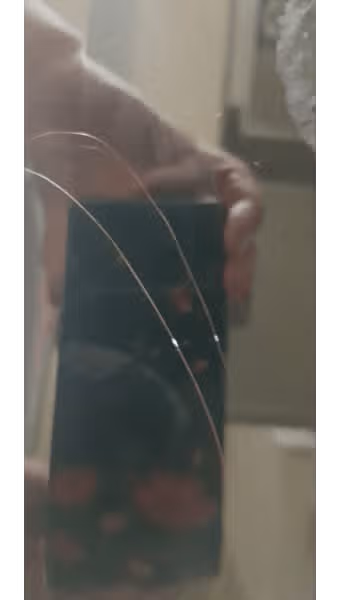질문) 머리를 감은 후에도 두피가 가려워요😱