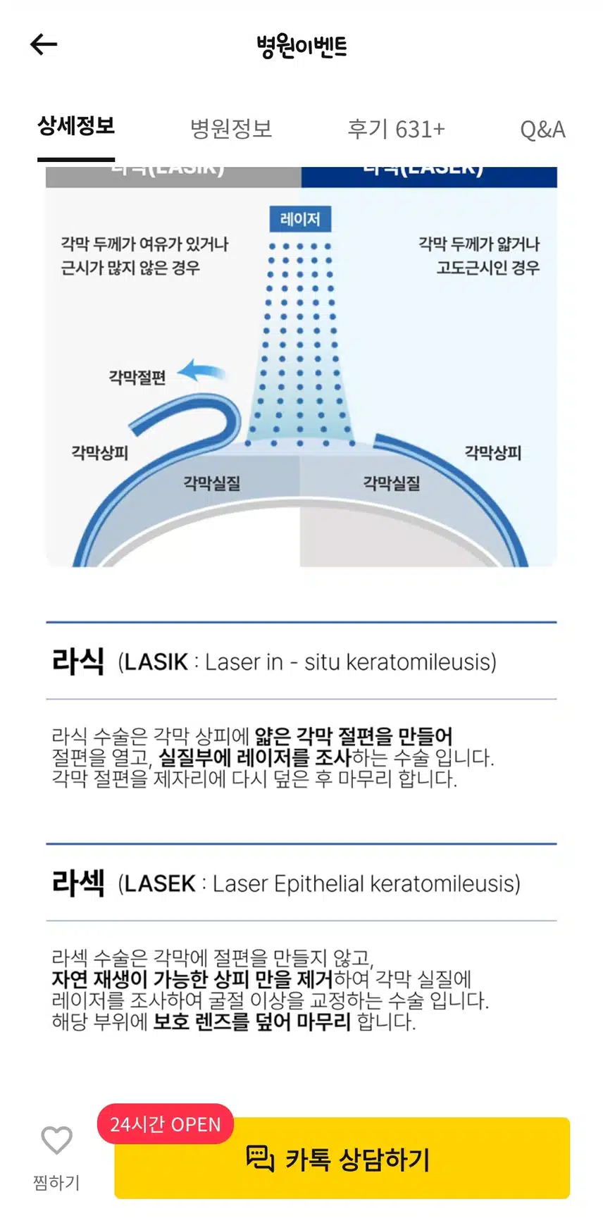 서울 강남구 강남푸른안과의 원데이라섹 후기 추천해요