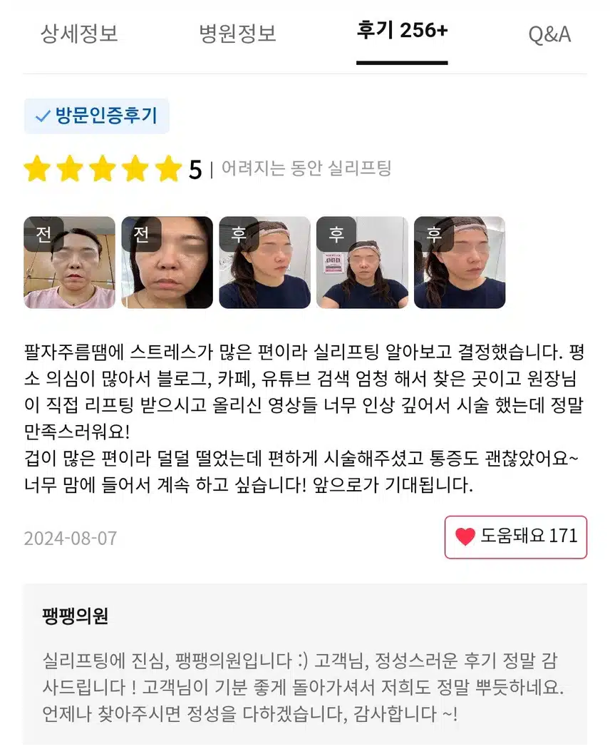 강남 팽팽의원 어려지는 동안 실리프팅 4.1만 후기 도움돼요